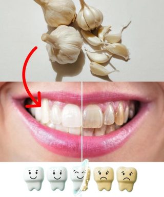Mejora tu salud bucal de forma natural con ajo.