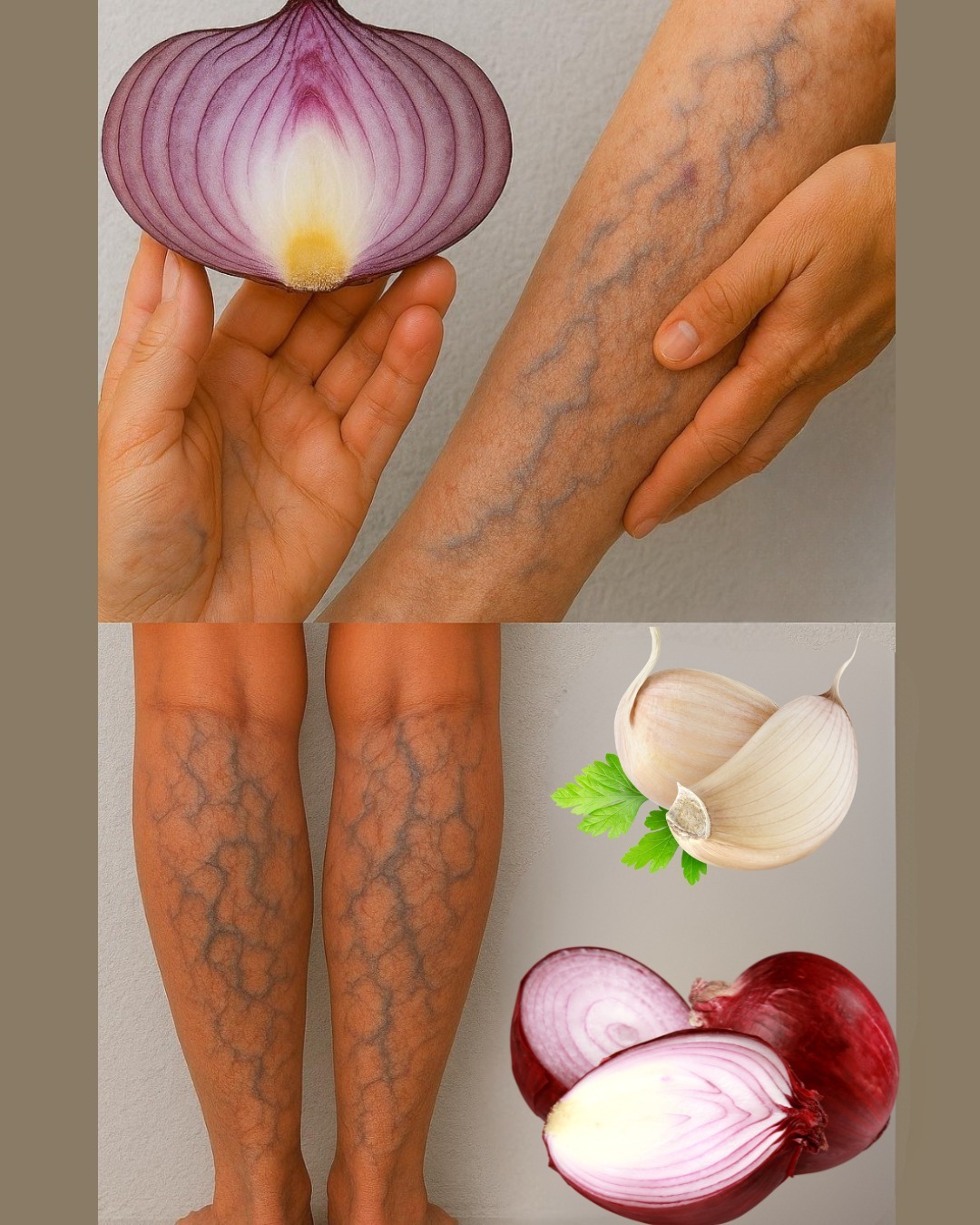 ¡Increíble! ¡Este es un eliminador de venas! Borra las várices como si fuera un borrador. Para seguir recibiendo mis recetas, solo debes decir algo… ¡Gracias!
